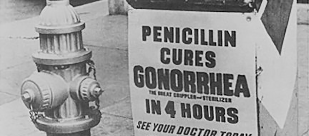 Gonorrhea